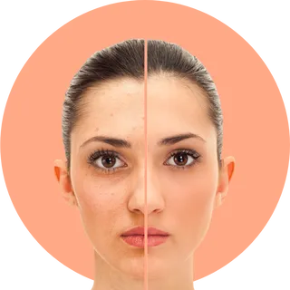 A photo of a woman before and after using a skincare product
